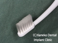 a)インプラント手術直後の歯ブラシ